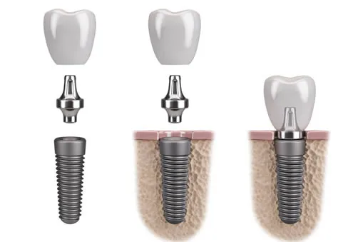 dental