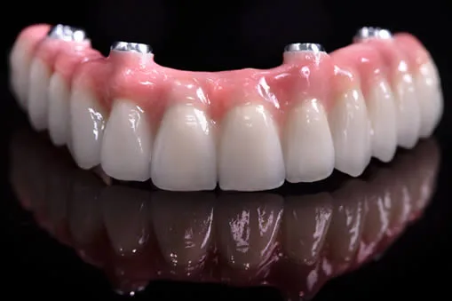 implant