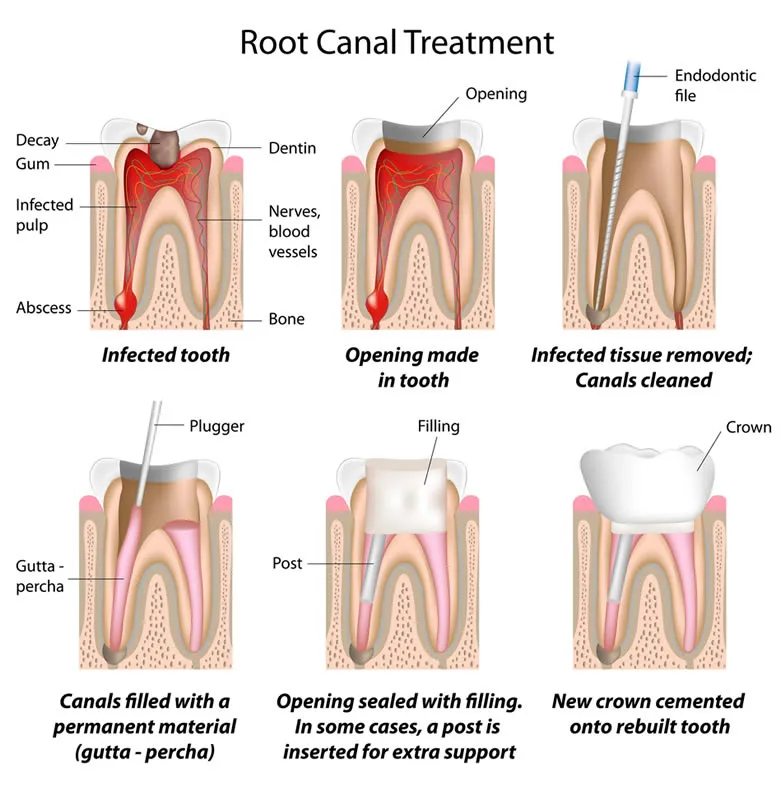 root