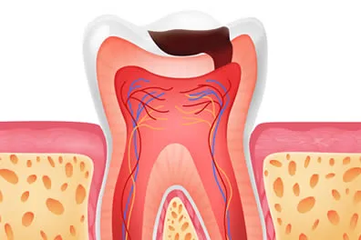 tooth